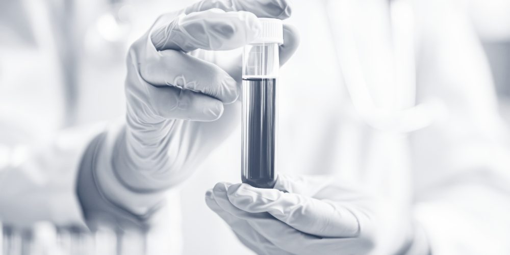 Out of Range Lab Results