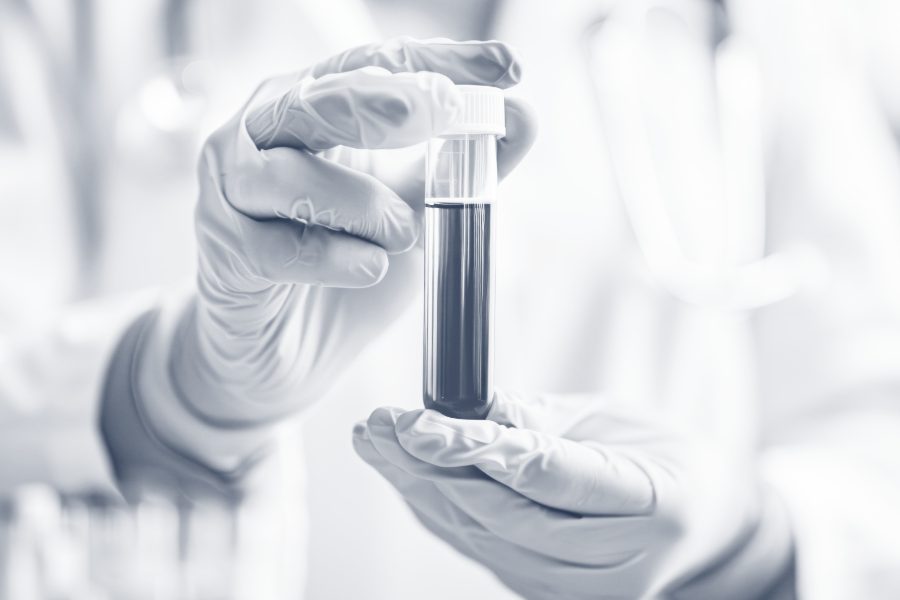 out of range lab results Out of Range Lab Results